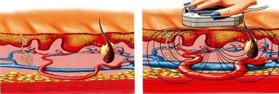 cando as pernas quedan entumecidos